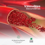 Vasculines Secundárias