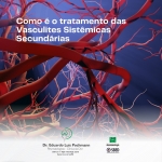 Tratamento das Vasculines Secundárias