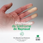 Diagóstico da Síndrome de Raynaud