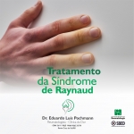 Tratamento da Síndrome de Raynaud