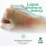 Lúpus - Sintomas da doença
