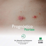 Prognóstico - Artrite psoriática