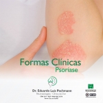 Formas clínicas - Psoríase